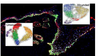 一項新研究揭示了皮膚細胞如何準(zhǔn)備好治愈傷口