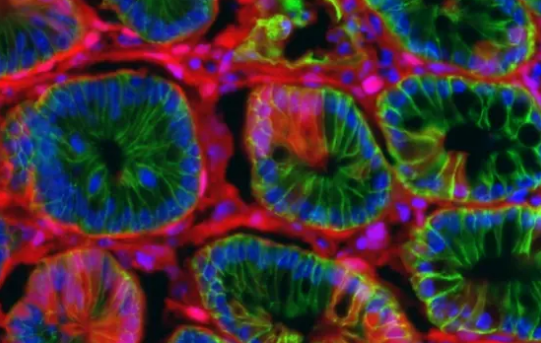 加速結(jié)腸癌研究的新模型