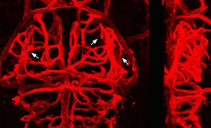 在發(fā)育過(guò)程中發(fā)現(xiàn)腦血管尋路的機(jī)制