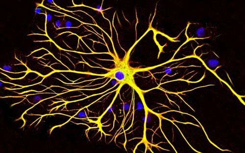 科學家發(fā)現大腦細胞從出生起就知道物體在重力作用下如何掉落