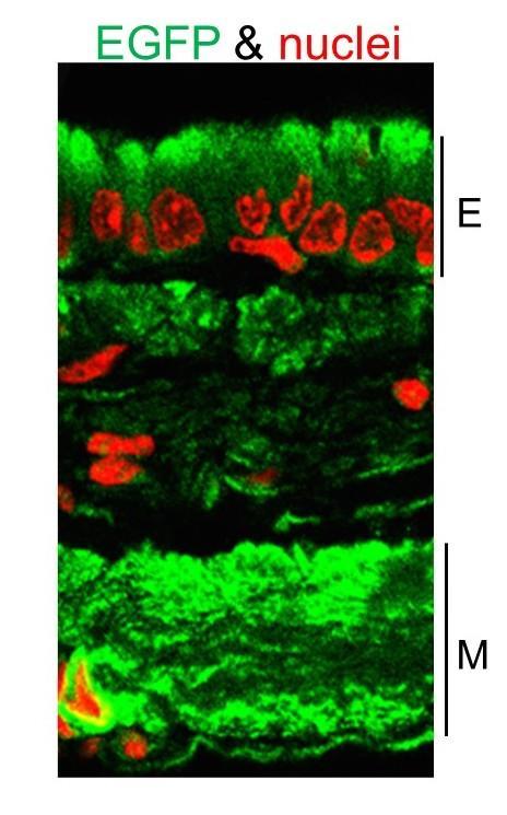 科學家展示了治療囊性纖維化的有希望的新方法