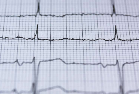 人工智能增強(qiáng)心電圖可以加速心力衰竭的診斷和治療