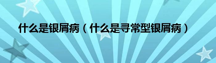 什么是銀屑?。ㄊ裁词菍こＰ豌y屑?。? /></span>
		<span id=