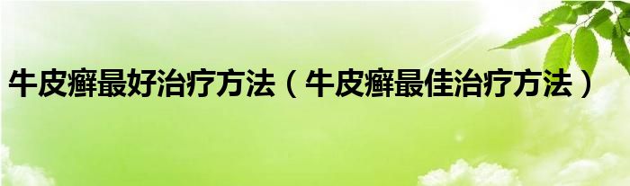 牛皮癬最好治療方法（牛皮癬最佳治療方法）