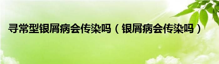 尋常型銀屑病會(huì)傳染嗎（銀屑病會(huì)傳染嗎）