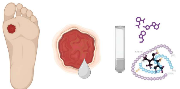 新研究發(fā)現(xiàn)胰島素和二甲雙胍組合有助于糖尿病足潰瘍愈合