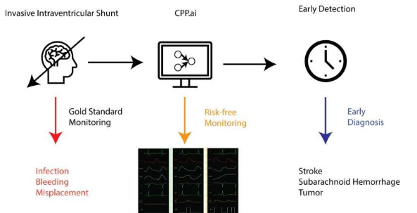 人工智能驅(qū)動的工具可以改善重癥監(jiān)護患者的腦壓監(jiān)測