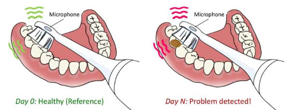 使用聲波牙刷探索牙齒健康感知