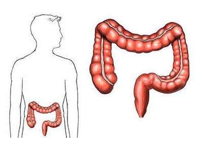 關(guān)于結(jié)腸癌的9個事實