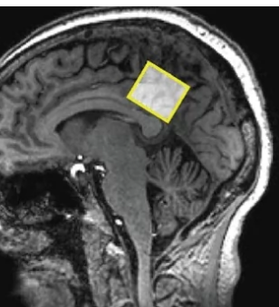 新的研究掃描了顯示大腦區(qū)域的MRI